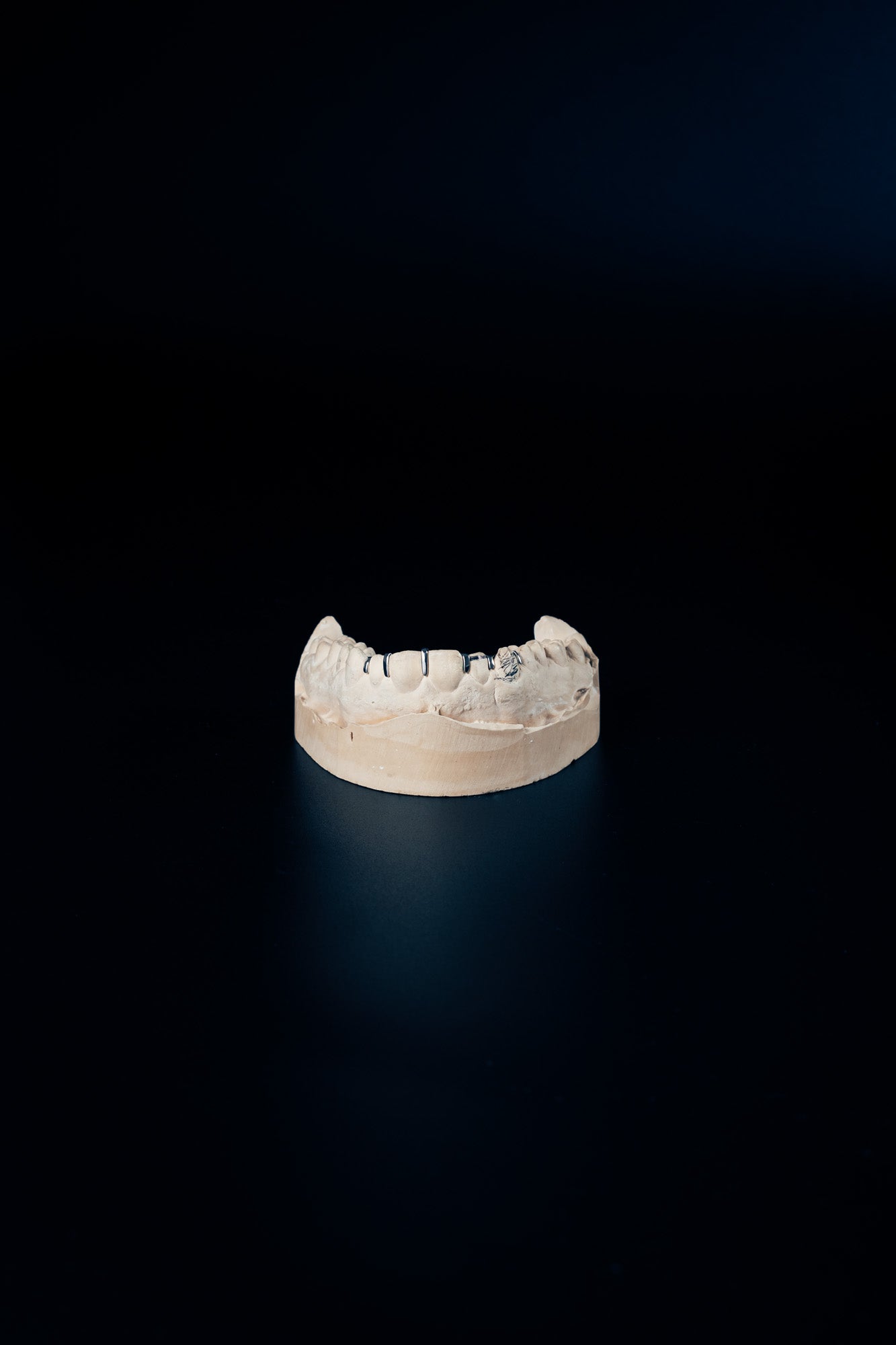 "Split Grillz – Clean Line Look"