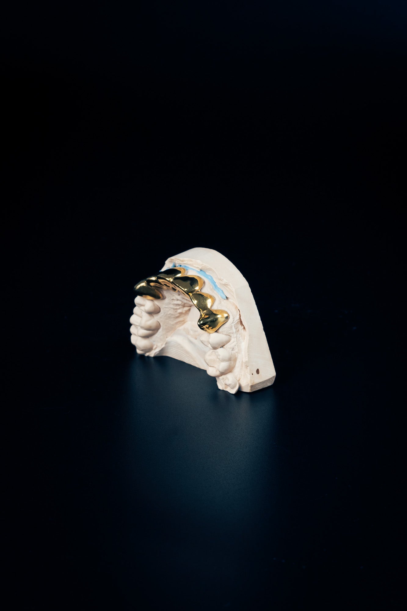 "Full Set Grillz – Chrome Finish"