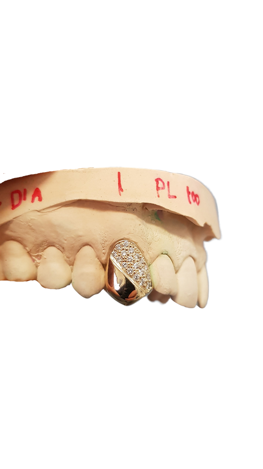 Diamond Grillz – Half Set