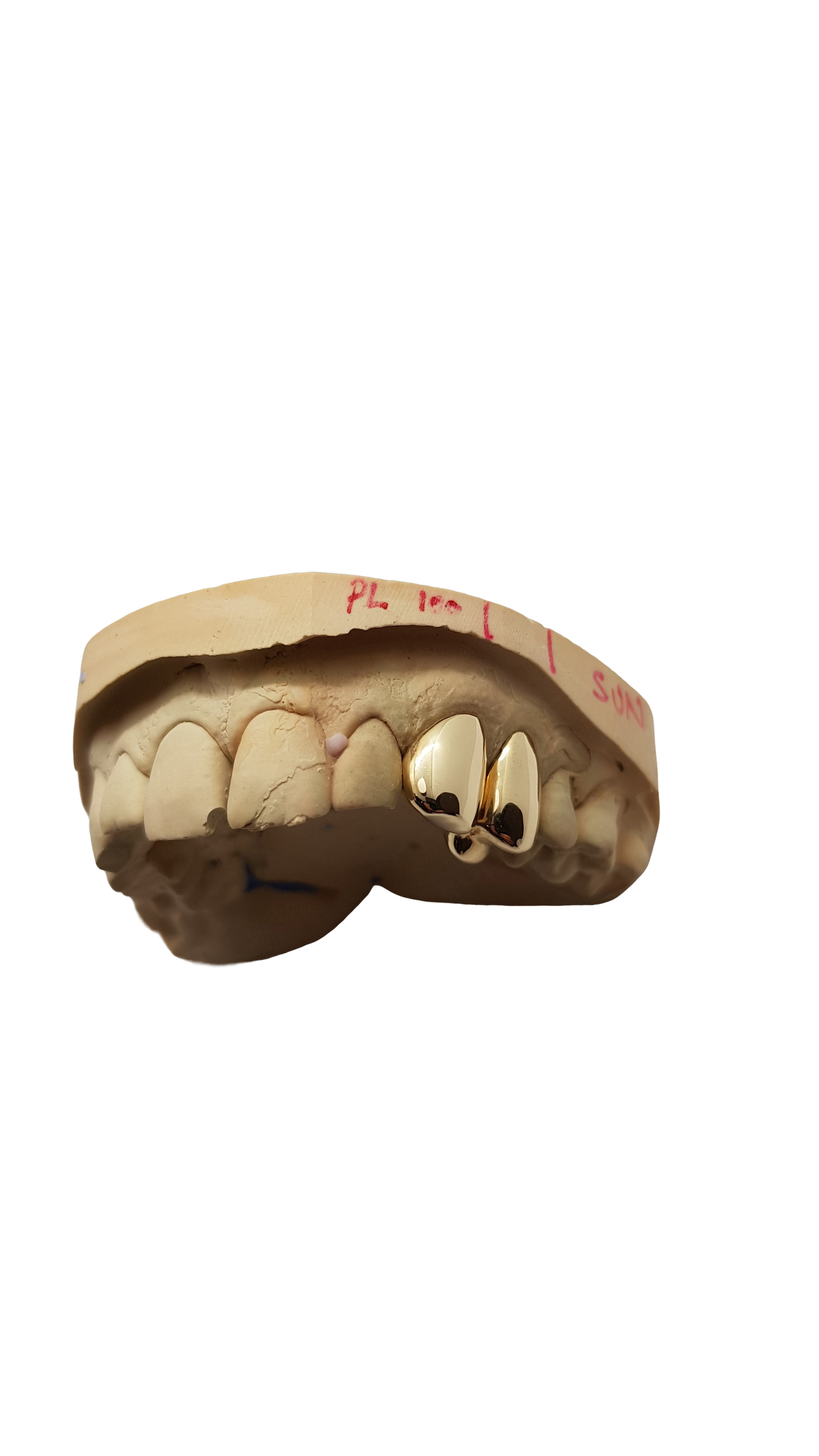 Gold Grillz plain
