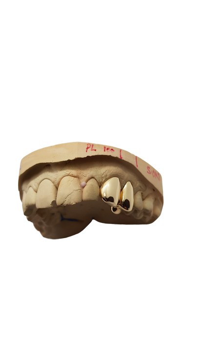 Gold Grillz plain