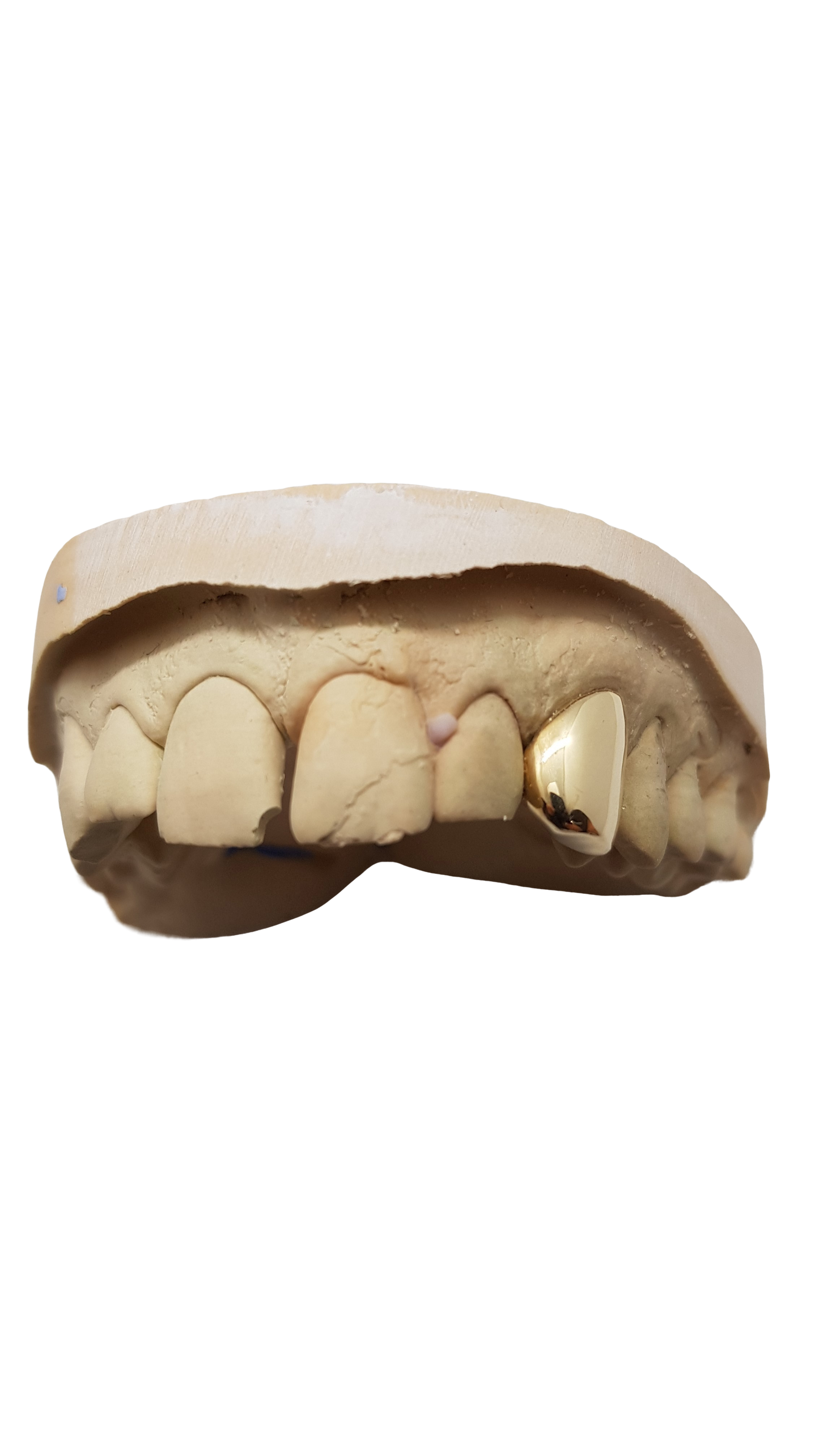 Gold Grillz plain