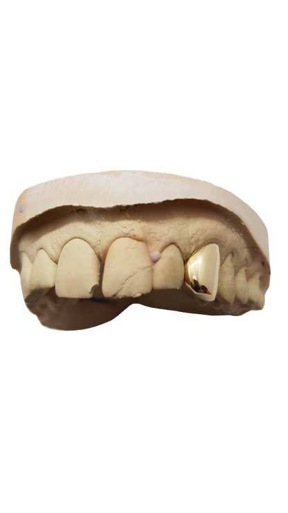 Gold Grillz plain