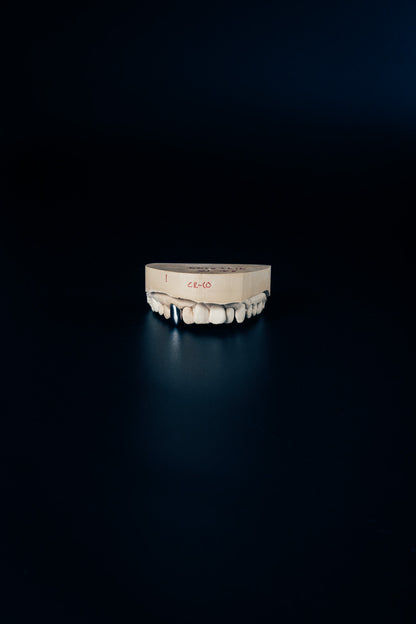 Chrome Grillz – Single Tooth