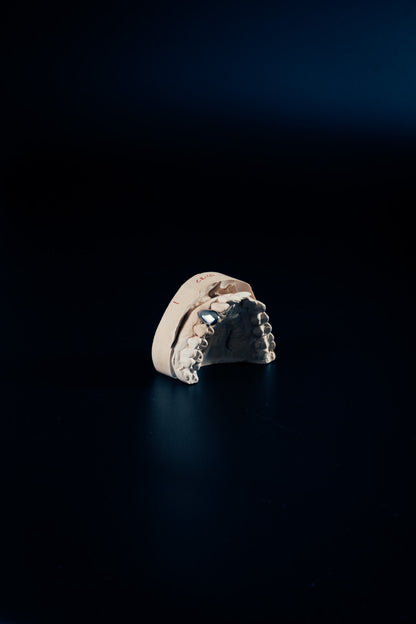 Chrome Grillz – Single Tooth