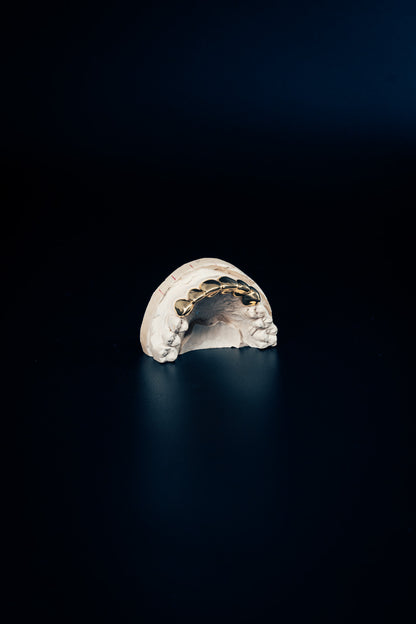 "Gold Grillz – 6 Piece Set"