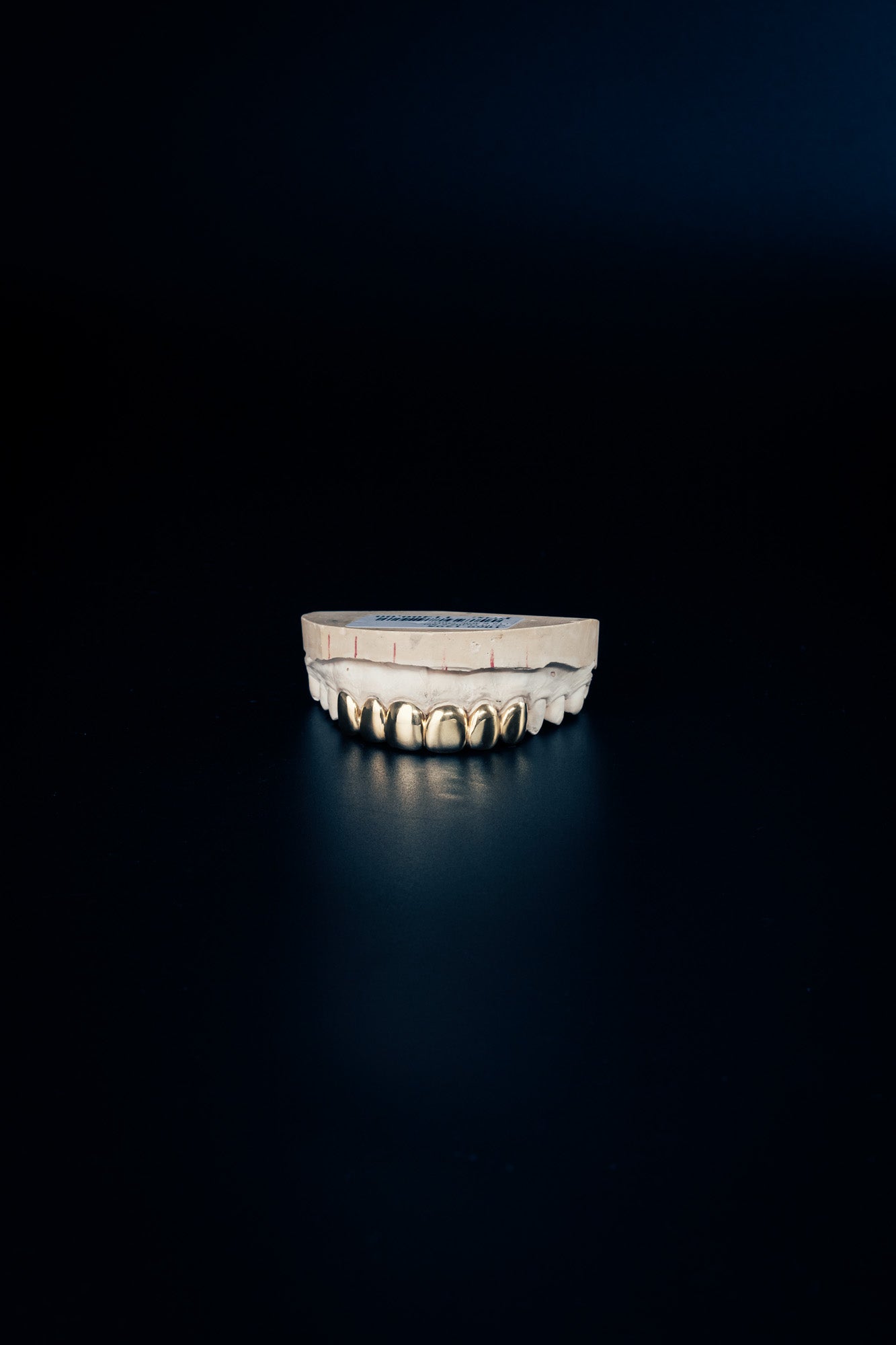"Gold Grillz – 6 Piece Set"