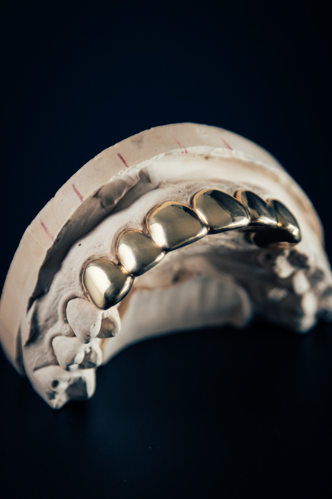 "Gold Grillz – 6 Piece Set"