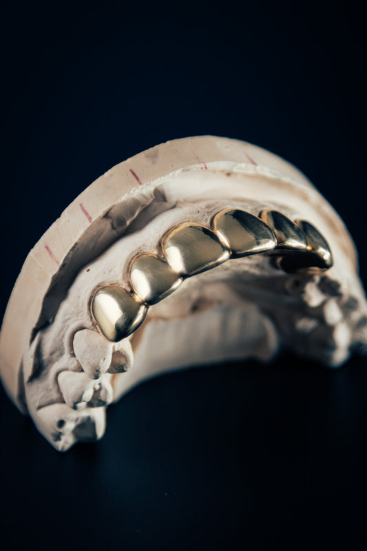 "Gold Grillz – 6 Piece Set"