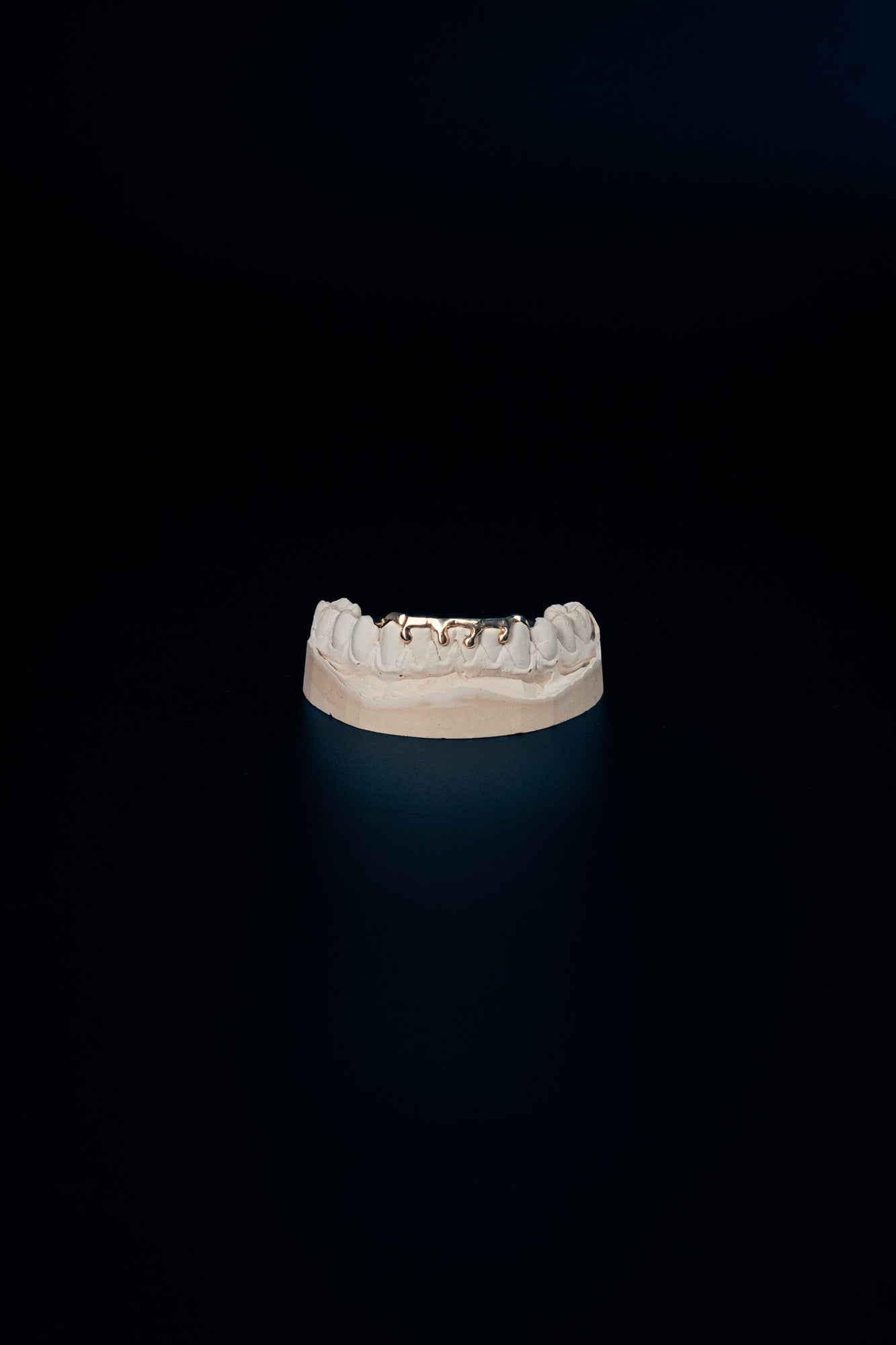 "Drip" (4 teeth)