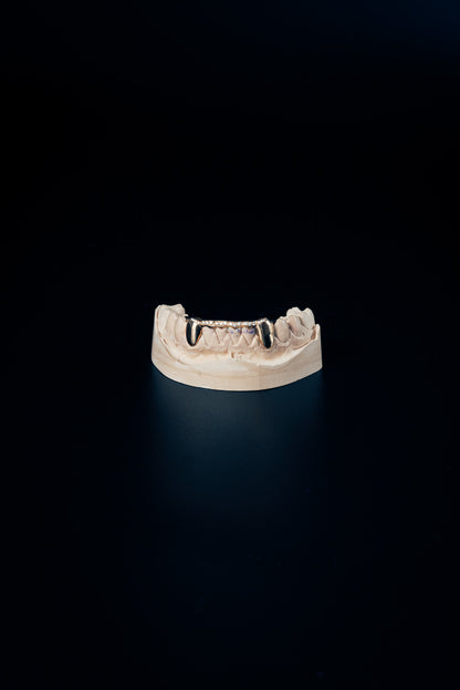 Diamond Bar "wave"