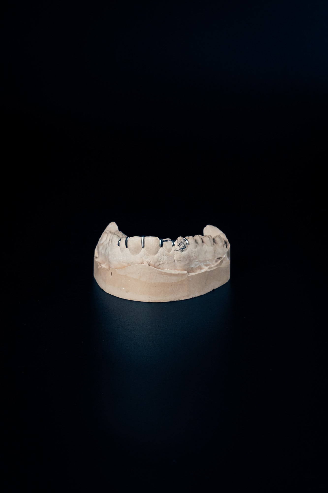 "Split Grillz – Clean Line Look"