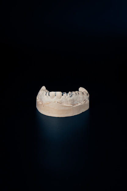 "Split Grillz – Clean Line Look"