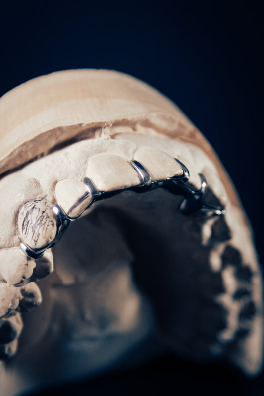 "Split Grillz – Clean Line Look"