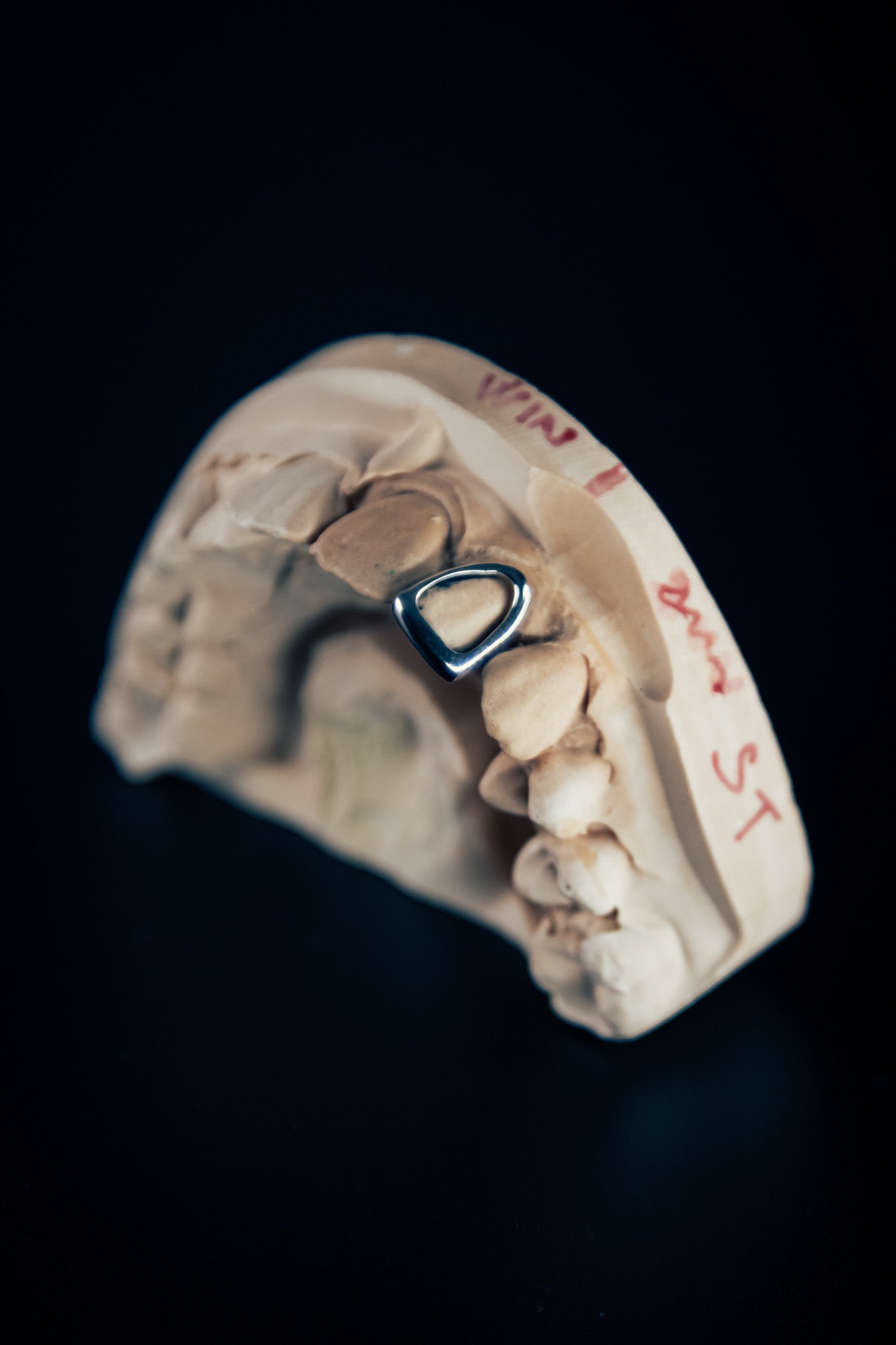 Chrome Grillz – Window Style