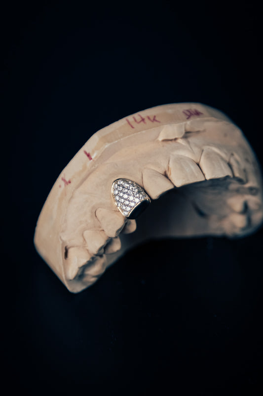 Full-ice grillz